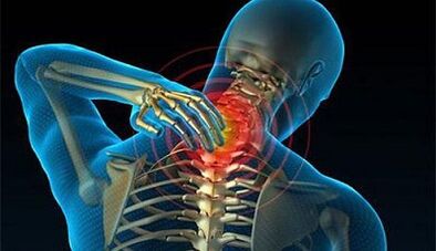 Symptoms of cervical spine osteochondrosis