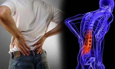 The reasons for the development of lumbar osteochondrosis